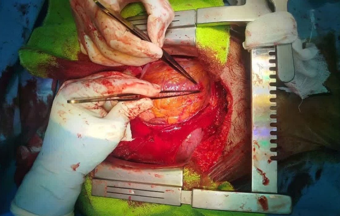 نجات جان جوان سبزواری که دچار پارگی قلب شده بود