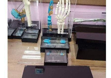 اختراع پژوهشگران مشهدی برای شکستگی مچ، ایده برتر در سال ۲۰۲۴