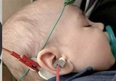 ۵۰ هزار نوزاد خراسانی تحت پوشش غربالگری شنوایی قرار گرفتند